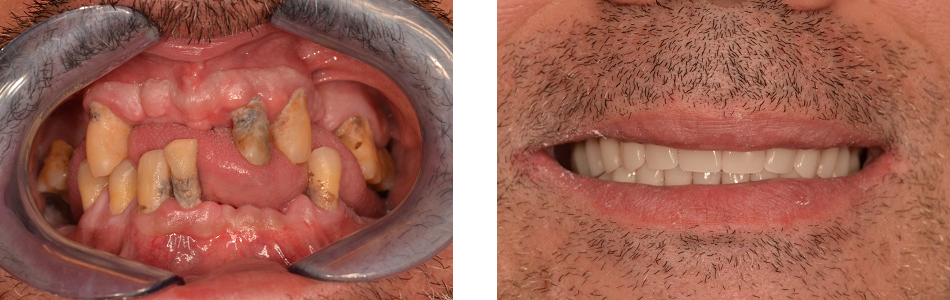 beforeafter2