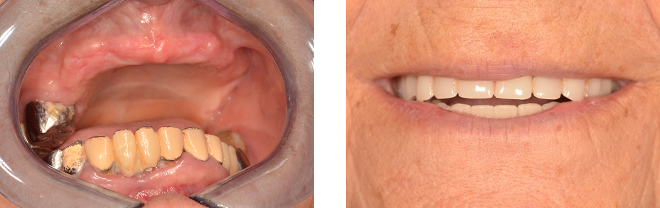 beforeafter3